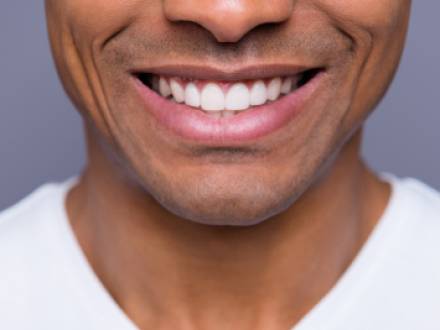 Falls Church, VA cosmetic dentist