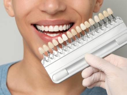 Springfield, VA cosmetic dentist